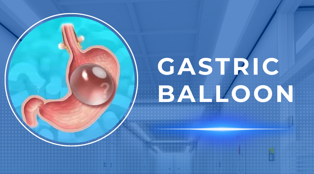 Gastric Balloon